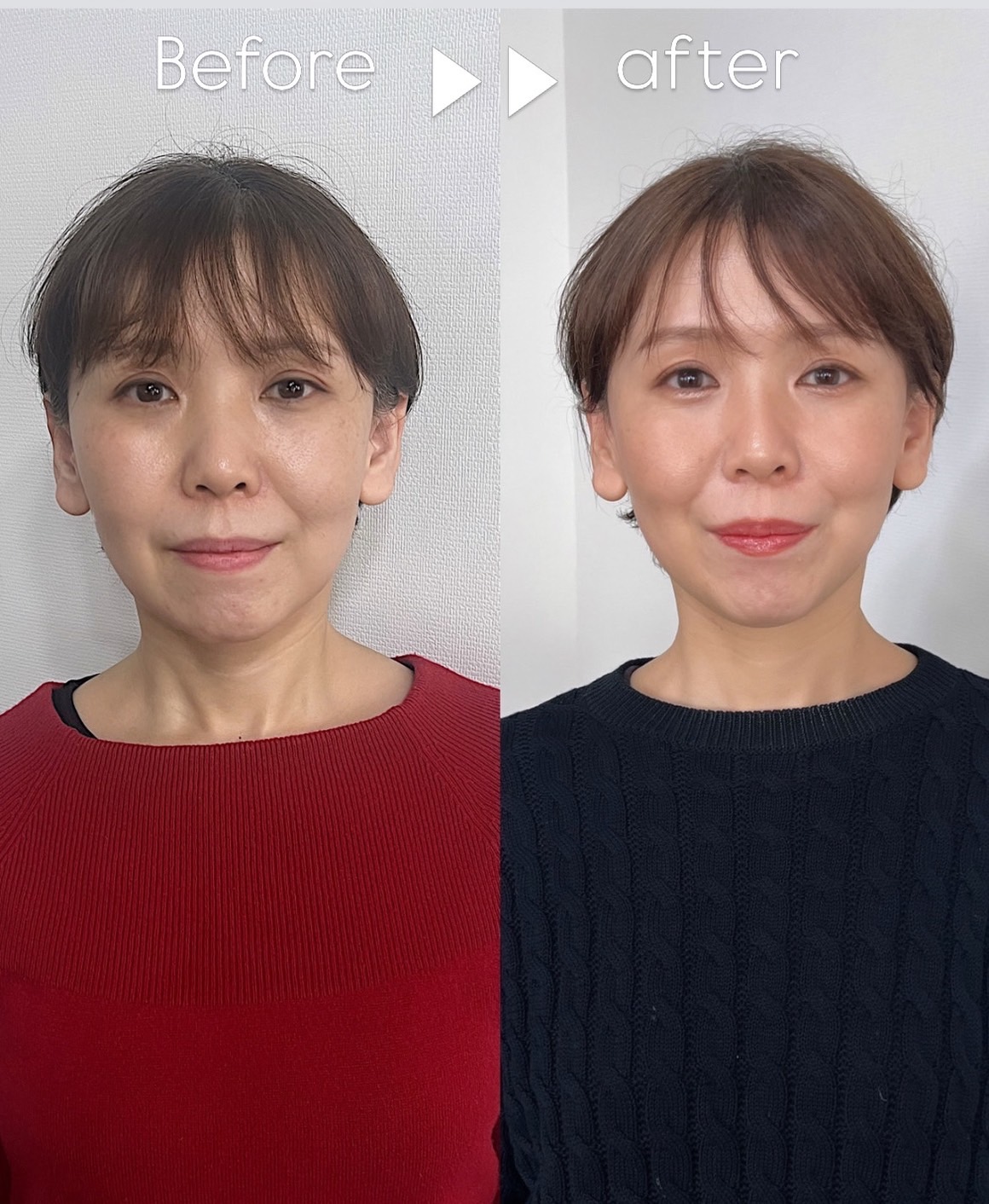 Before & After 03